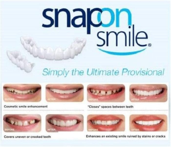 Snap On Smile Teeth Cosmetic Natural Instant Veneers Dental Fake Tooth Cover